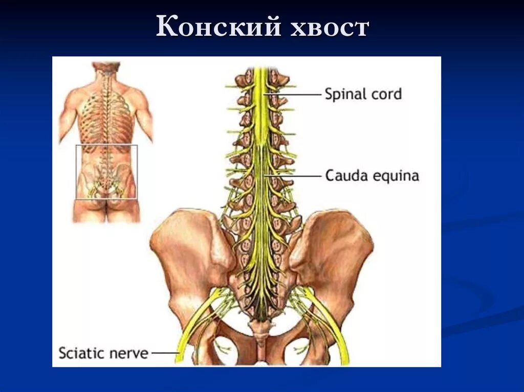 Конский хвост позвоночника седалищный нерв. Конский хвост спинного мозга. Позвонки человека спинной мозг анатомия. Конский хвост спинного мозга человека.