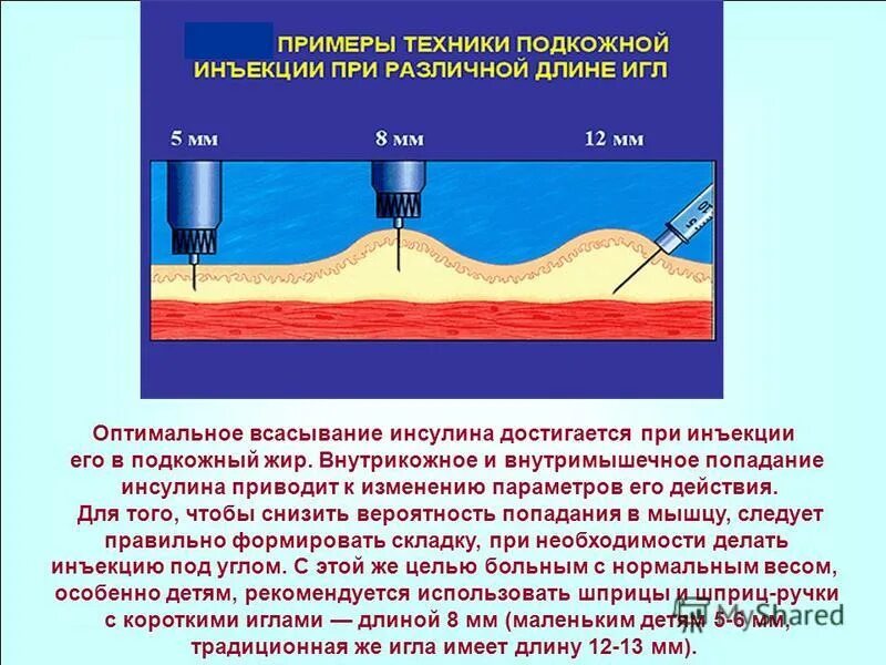 Угол иглы при введении инсулина. Введение иглы при инсулине. Введение инсулина подкожно. Всасывание инсулина. Действие при уколе иглой