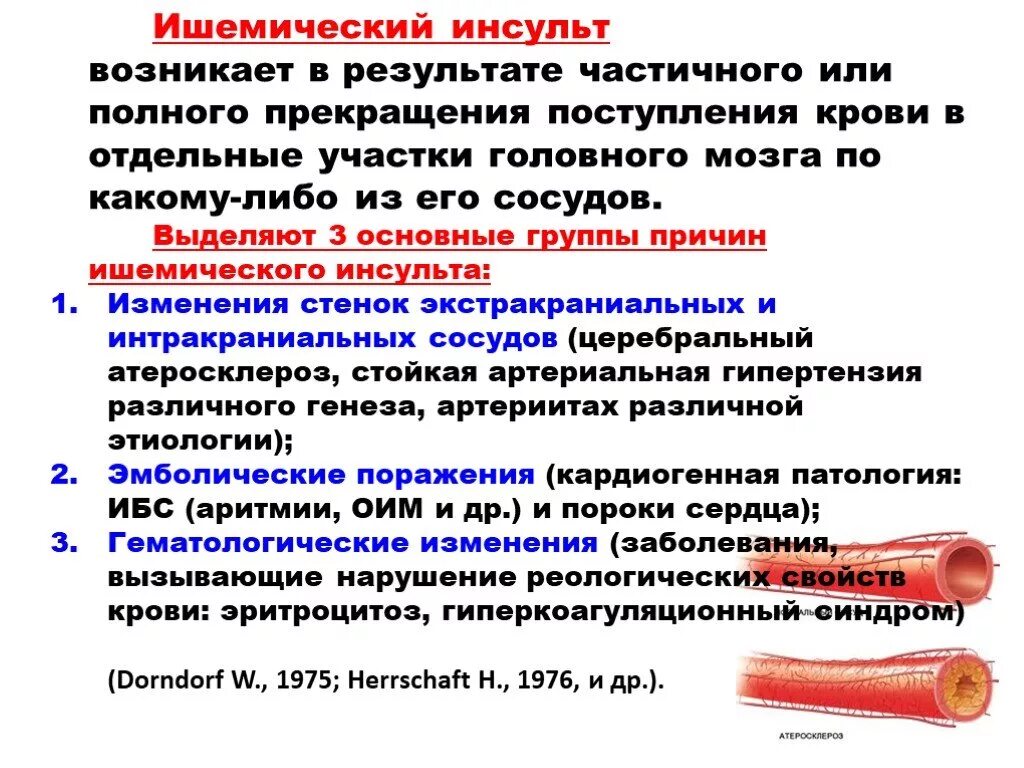 Ковид инсульт. Предпосылки ишемического инсульта. Мришемического и нсульта. При ишемическом инсульте развивается. Причины развития ишемического инсульта.