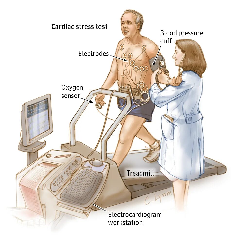 Тредмил стресс тест. Нагрузочный тредмил тест. Нагрузочные пробы в кардиологии. ЭКГ стресс-тест с физической нагрузкой.