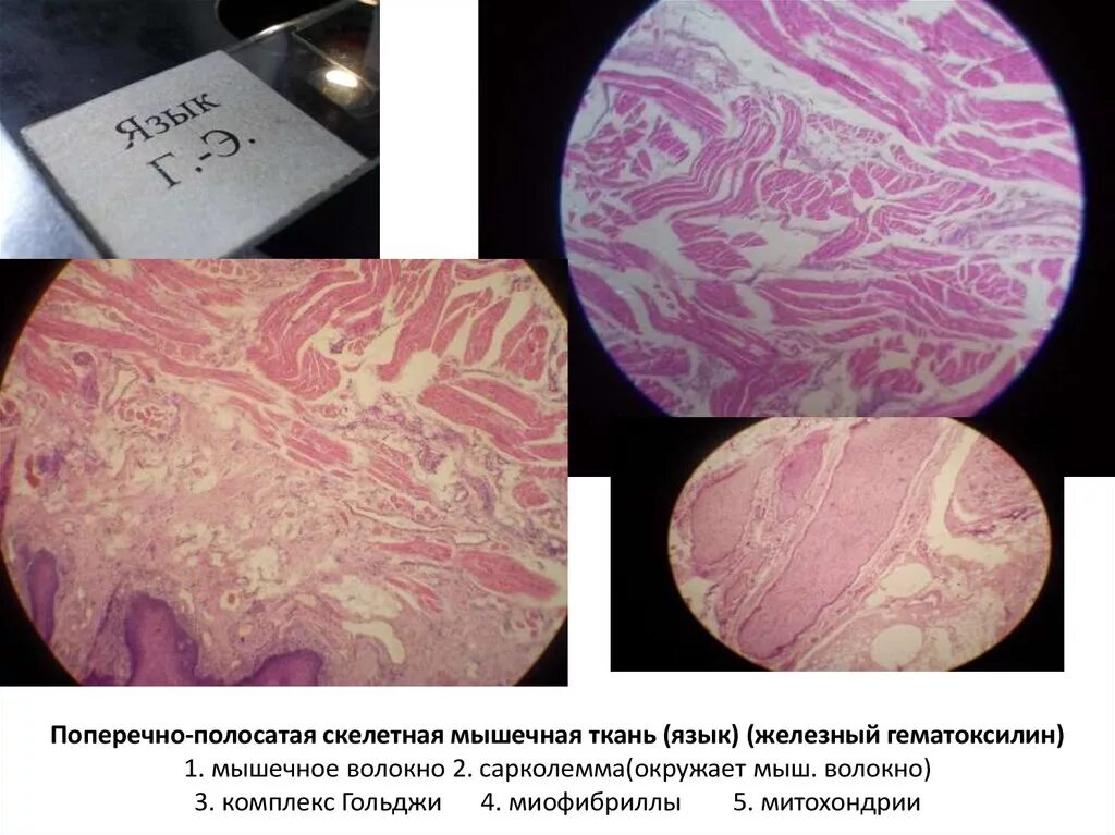 Поперечно полосатая мышечная ткань Железный гематоксилин гистология. Скелетная мышечная ткань гистология гематоксилин. Железный гематоксилин гистология. Поперечно полосатая мышечная ткань языка кролика гистология. Препарат поперечно полосатая мышечная ткань