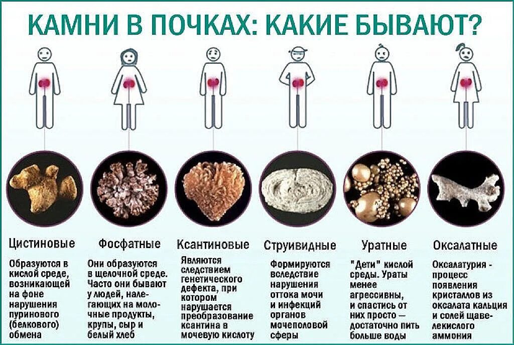 При каких заболеваниях пьется