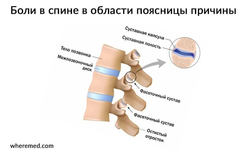 Год болит поясница