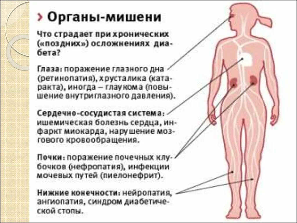 5 органы мишени. Сахарный диабет поражение. Сахарный диабет поражение органов. Заболевания органов кроветворения у детей.