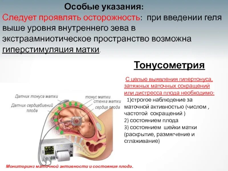 Что такое гипертонус матки. Маточный тонус. тонус матки при.