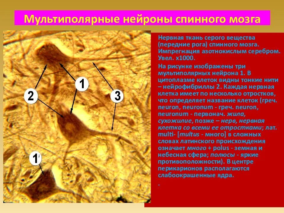 Мультиполярные Нейроны спинного мозга гистология препарат. Спинной мозг импрегнация серебром препарат. Мультиполярный Нейрон импрегнация серебром. Гемангиоперицитома спинного мозга гистология.