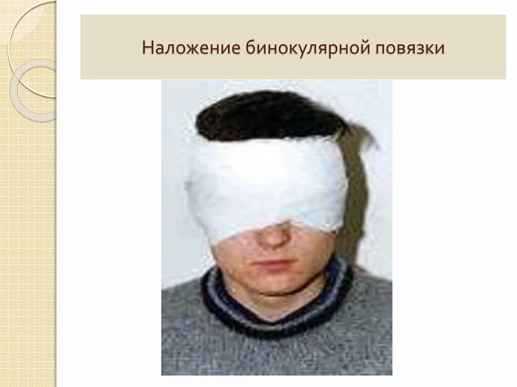 Как перевязать глаз. Бинокулярная повязка на оба глаза. техника наложения бинокулярной повязки. монокулярная повязка алгоритм. монокулярная и бинокулярная повязка на глаза.