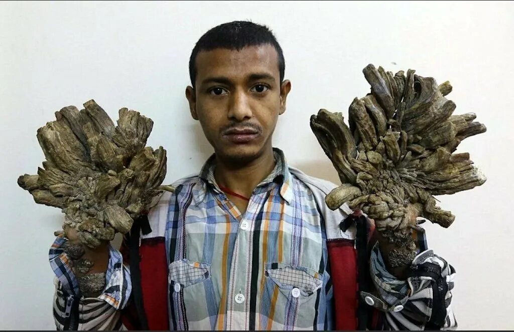 Человек растение заболевание. Кристина бузина. Сбор лекарственных растений. Эрготизм антонов огонь. Человек растение заболевание.