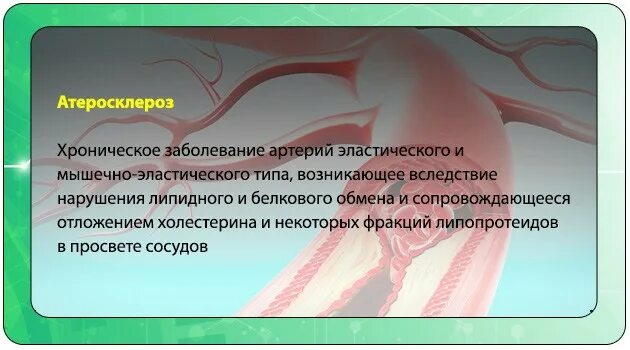 Атеросклероз нижних конечностей народное лечение. Атеросклероз заболевание артерий эластического. для сосудов ног народные средства. атеросклероз очищение сосудов. атеросклероз сосудов конечностей.