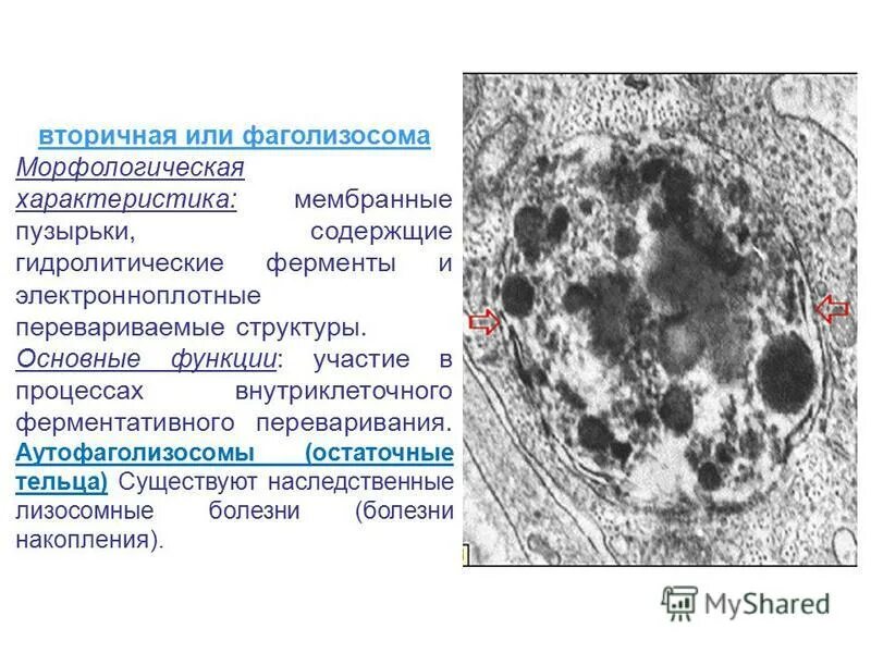 Фаголизосома Электронограмма. Фаголизосома функции. Внутренняя структура телолизосомы. Аутолизосомы функции. Фаголизосома