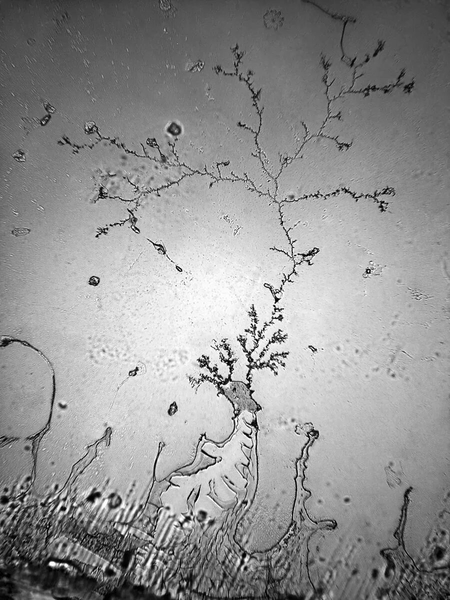 Как выглядит слеза под микроскопом. Слеза под микроскопом. Разные слезы под микроскопом. Веснушки под микроскопом. Слеза под микроскопом.