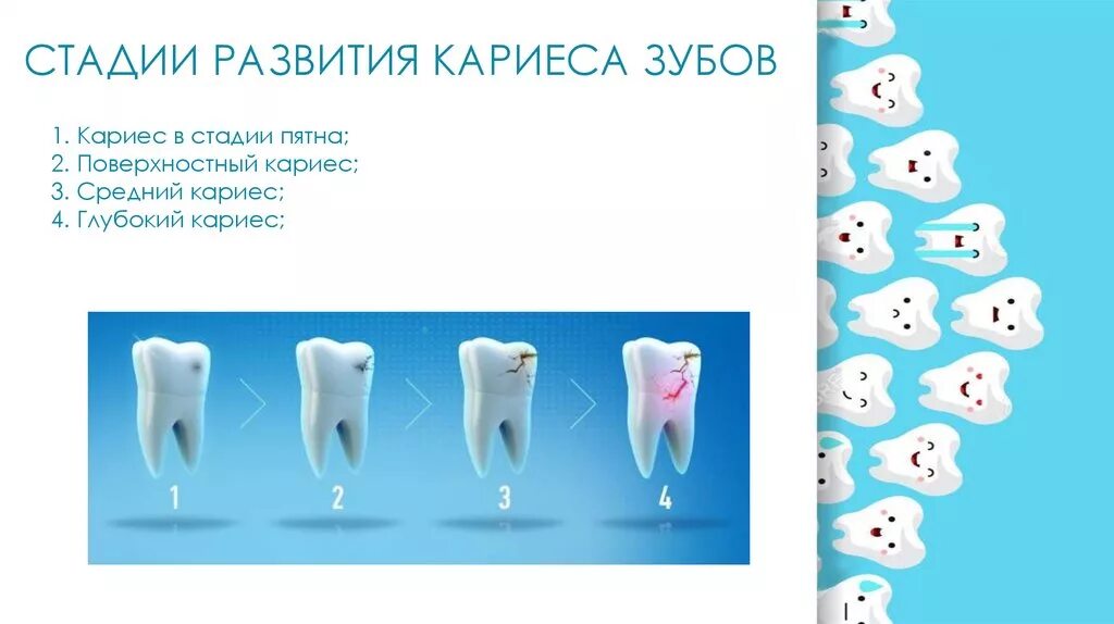 Сколько развивается кариес. Стадии развития кариеса. стадии формирования кариеса.