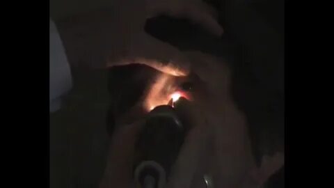 Диафаноскопия