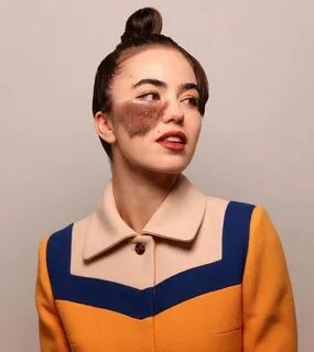 Лена с пятном на лице