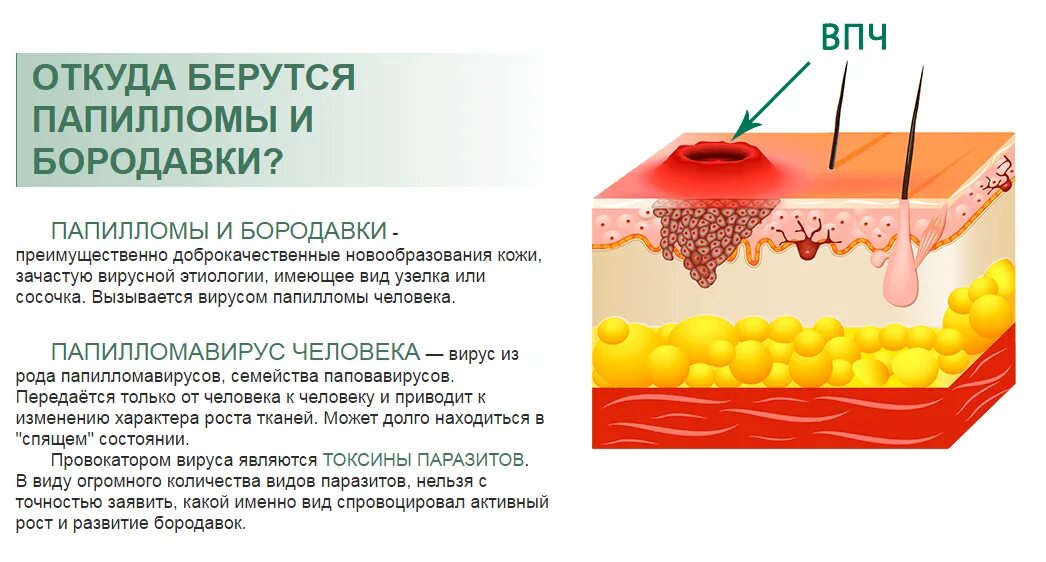 Почему из члена кровь. Подошвенная бородавка вирусная инфекция.