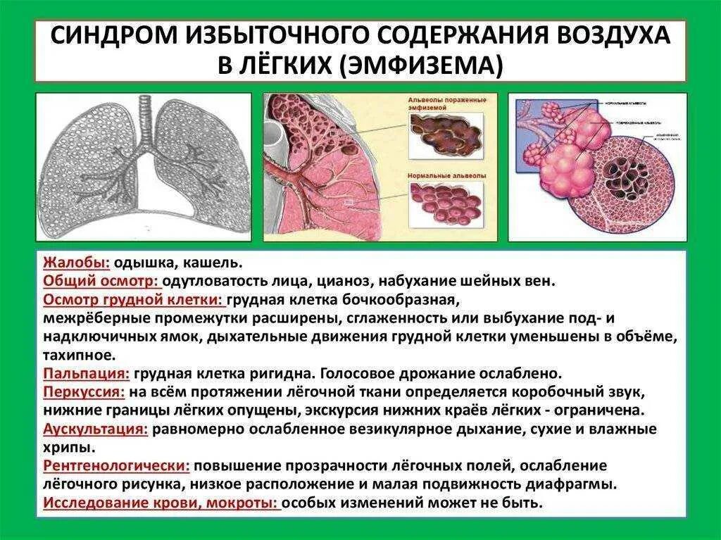 Эмфизематозная перестройка легочной ткани что такое. Экспираторная эмфизема. Патогенез первичной эмфиземы. Очаговая эмфизема легких. Эмфизема легких развивается при.
