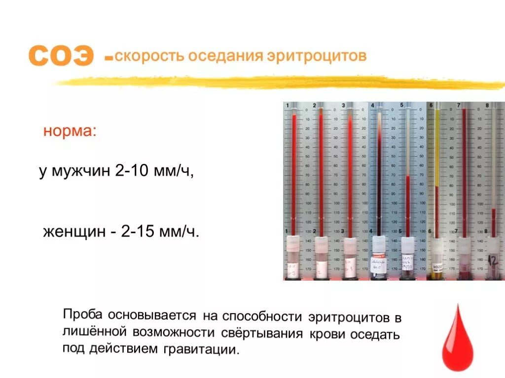 Сильно повышен соэ. Норма оседание оседания эритроцитов. СОЭ 41мм/ч. Показатели СОЭ В крови норма. Высокая скорость оседания эритроцитов в крови.