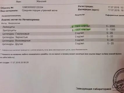 Анализы мочи при беременности 2 триместр