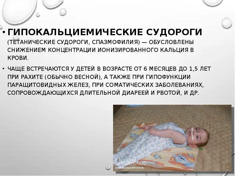 Судороги при температуре у ребенка симптомы