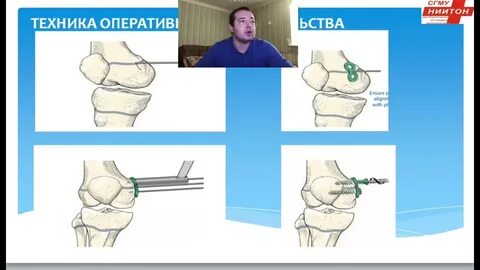 Вестник травматологии