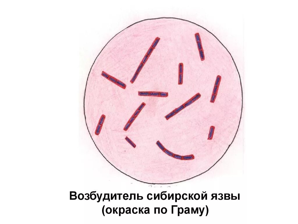 Препарат сибирская язва. Сибирская языасимптомы. Бациллы сибирской язвы окраска по граму. Осторожно сибирская язва. Возбудитель сибирской язвы микробиология.
