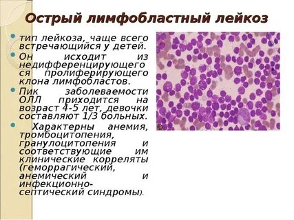 Иммунный лейкоз