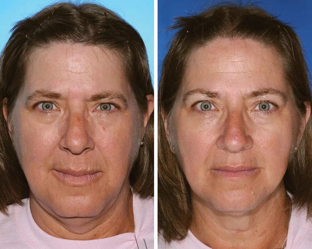 Курящая женщина страшная. Пожилые курильщицы. Курение после 50 лет. Кожа курящих и некурящих. Начала курить после 40 лет.