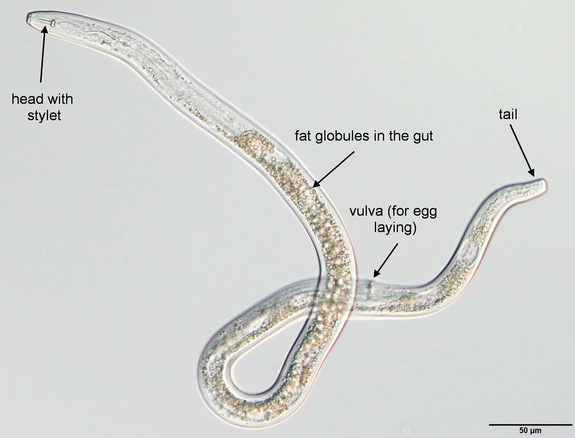 Острица власоглав трихинелла. Острица власоглав трихинелла. Острица власоглав трихинелла. Трихоцефалез – власоглав. Аскариды острицы власоглав трихинеллы токсокары.