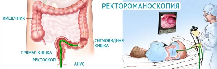 Ощущение в прямой кишке