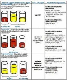 Инфекции через мочу