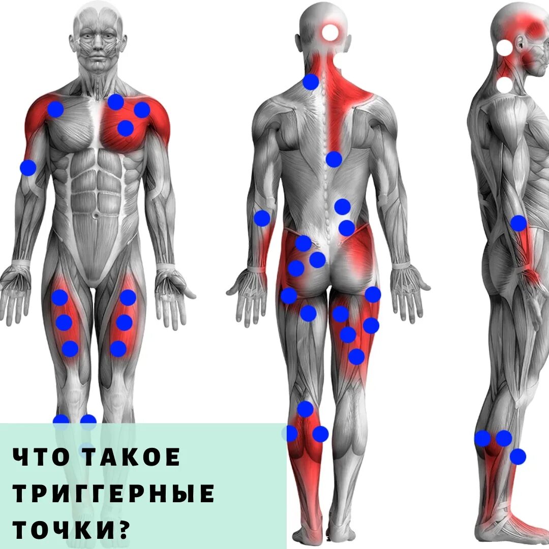 Тт1 триггерная точка. Карта триггерных точек. Атлас триггерных точек человека. Триггерные точки атлас. Триггерные точки это простыми словами