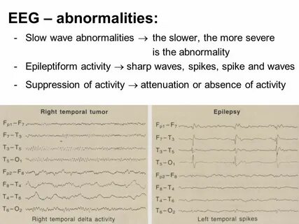 Slow wave