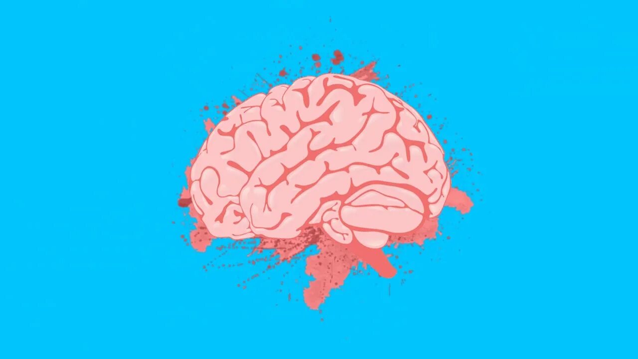 Brain test 433