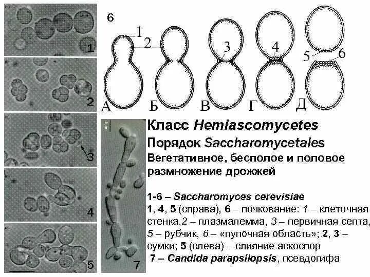 Тело пекарских дрожжей состоит из. Пекарские дрожжи Saccharomyces cerevisiae. Строение клетки дрожжи Saccharomyces cerevisiae. Дрожжи Saccharomyces cerevisiae строение. Клетка Saccharomyces схема.