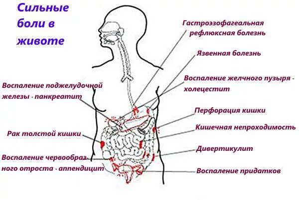 Причины ноющей боли в правом боку. Боль слева внизу живота у мужчин. сильно болит левая сторона живота снизу. болит в нижней части живота слева. болит в нижней части живота слева у мужчин.