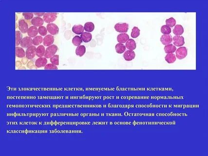 Бластные клетки