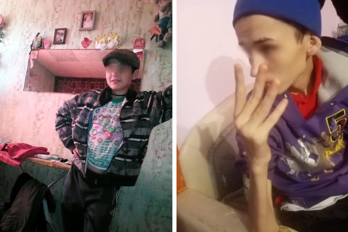 умственно отсталый парень