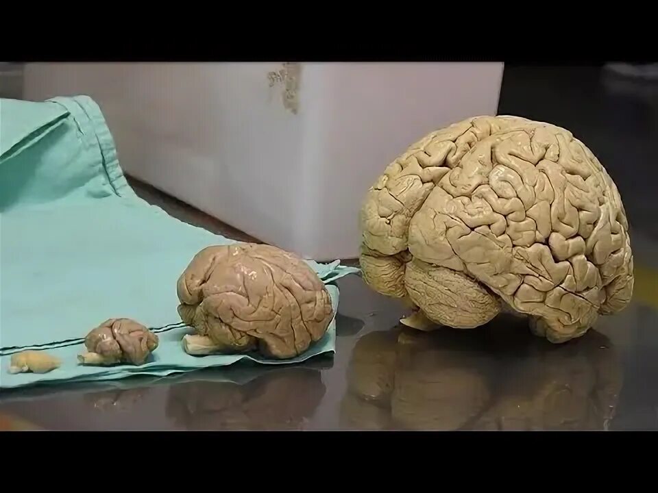 Neuroscience Letters Wikipedia audio article - YouTube