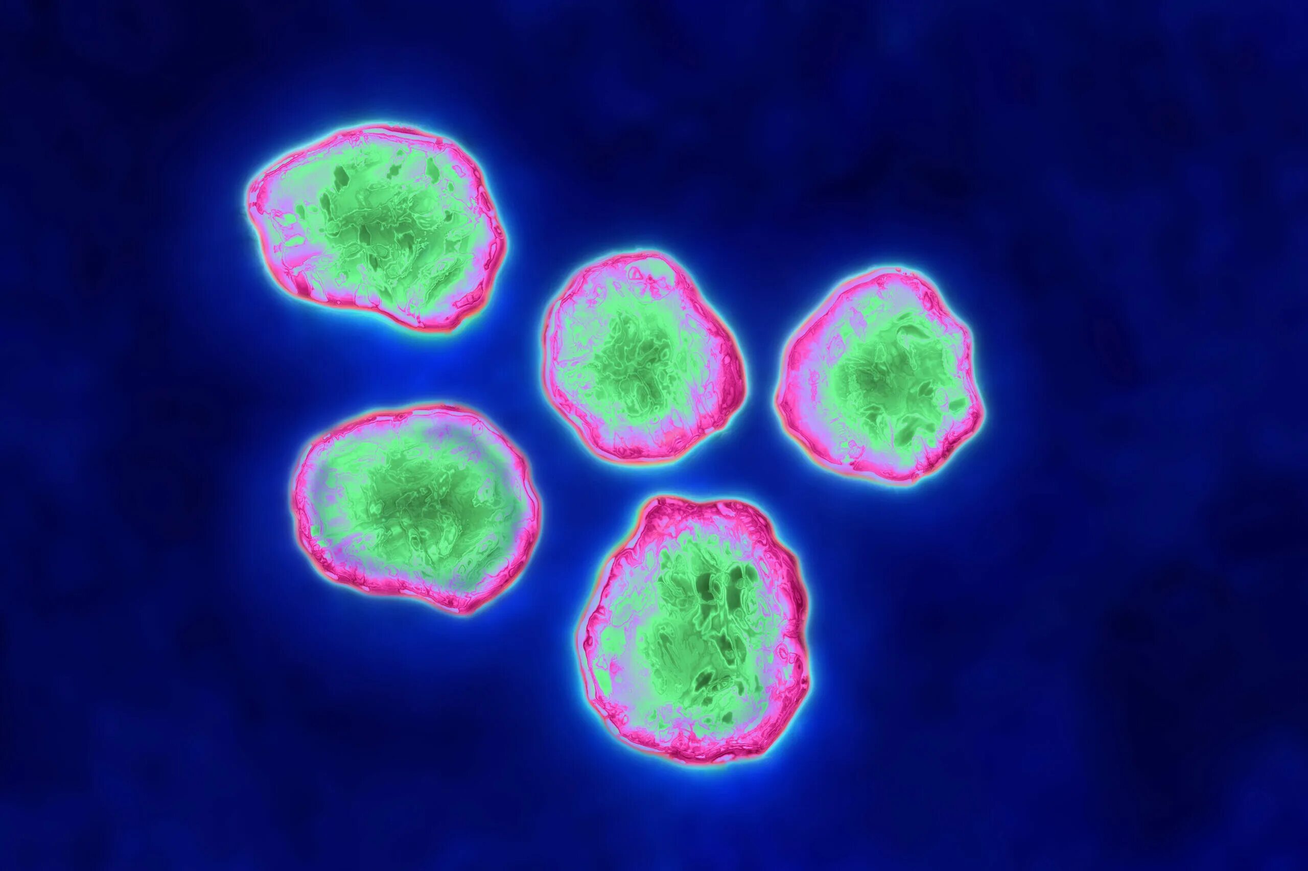 Вирус кори возбудитель. Вирус кори под микроскопом. Вирус кори микробиология. Measles Morbillivirus.