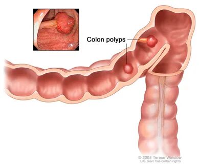 Our Surgery Treatments - Excel Laparoscopy Hospital Surat Gujarat