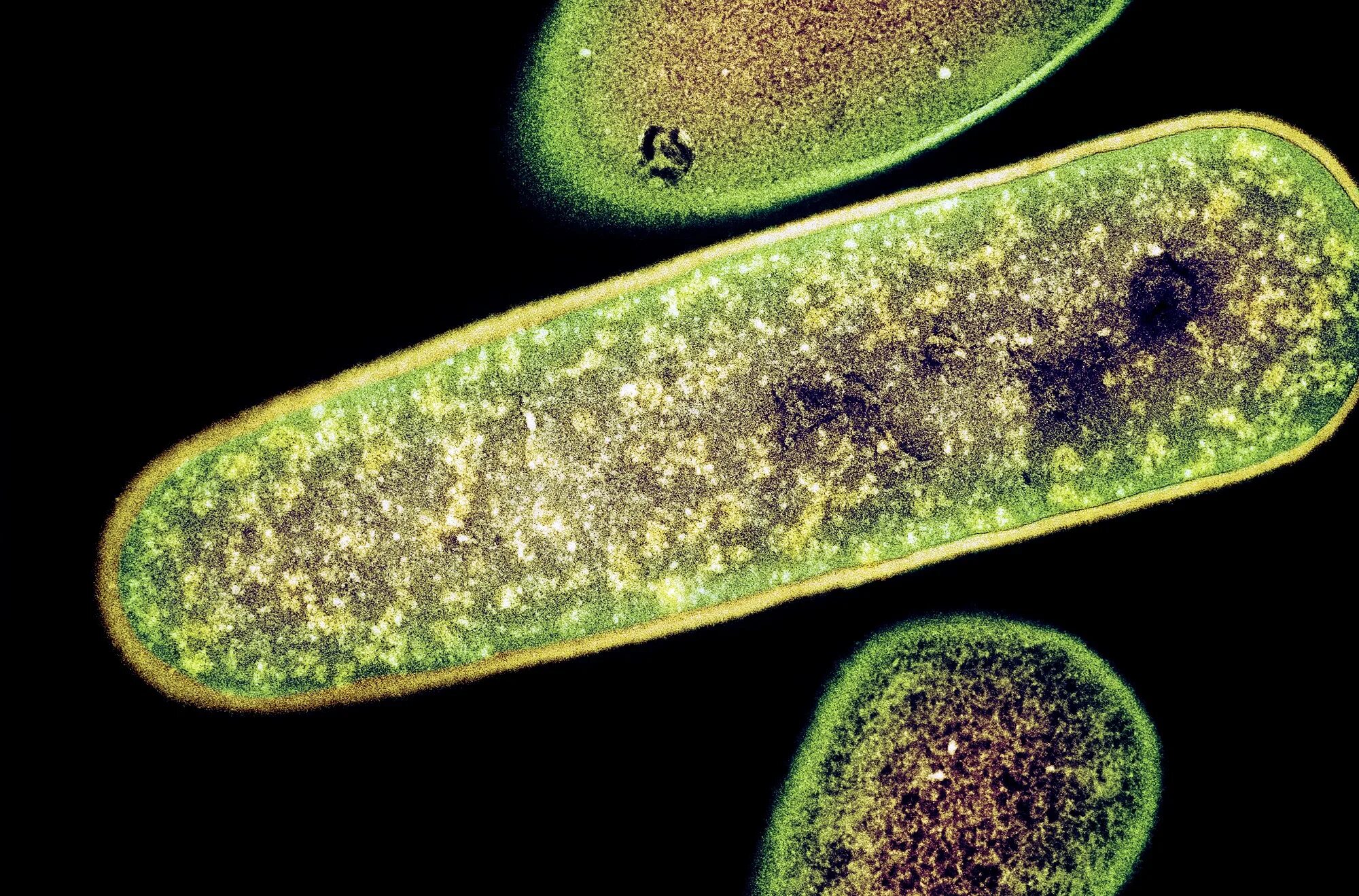 Clostridium spp. Бактерии клостридиум. Клостридии бактерии. Микроорганизмы клостридия.