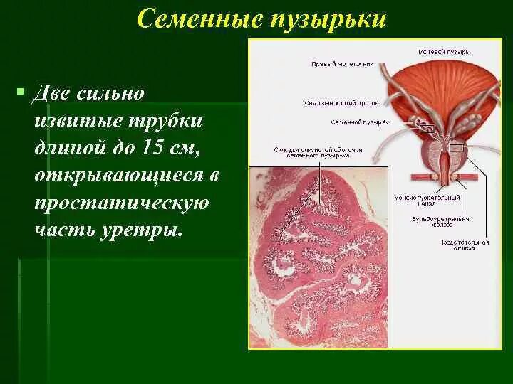 Семенные пузырьки железы. Проток семенного пузырька анатомия. Предстательная железа и семенные пузырьки анатомия. Слизистой оболочке семенного пузырька свойственно. Семенные пузырьки строение.