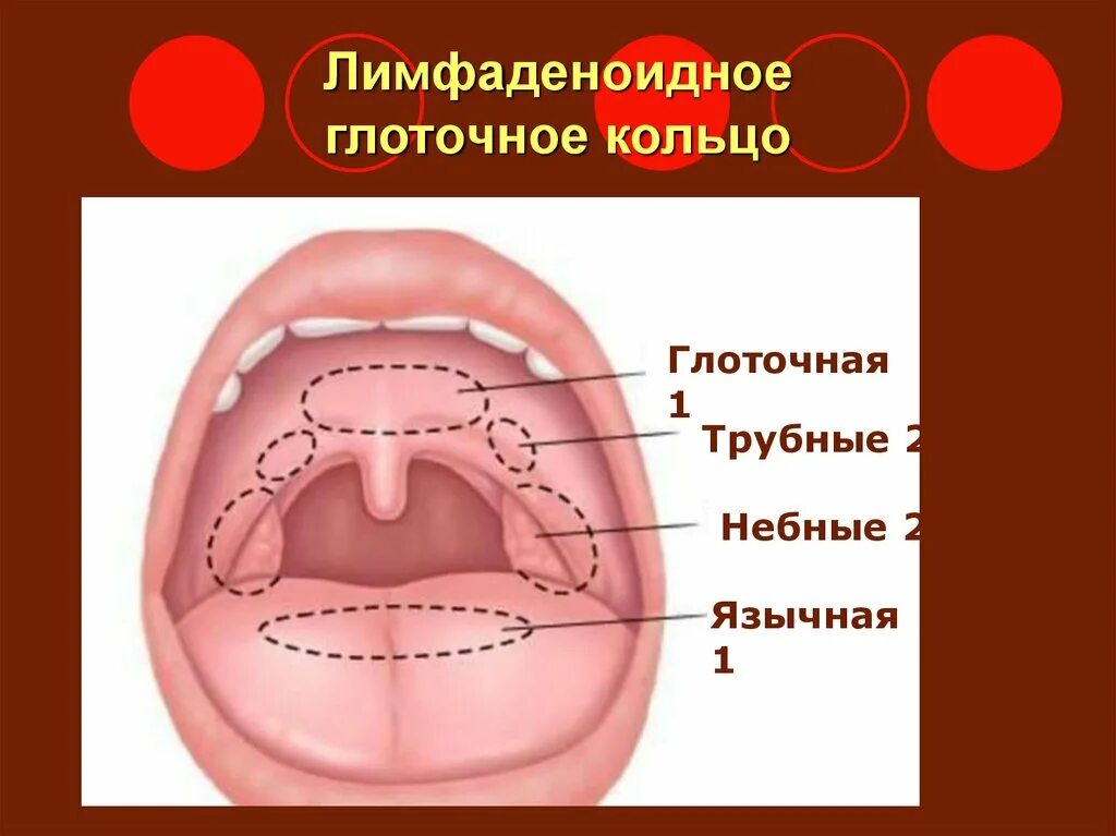 Лимфаденоидное глоточное кольцо Вальдейера-Пирогова. Миндалины лимфоидного кольца Пирогова-Вальдейера. Миндалины глоточного кольца Пирогова Вальдейера. Лимфоэпителиальное кольцо Пирогова-Вальдейера миндалины. Валики глотки