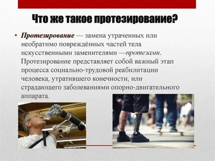 Протезы описание