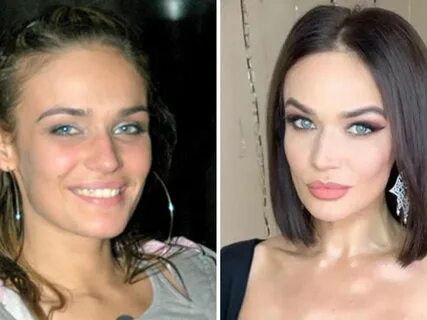 Водонаева до и после пластики