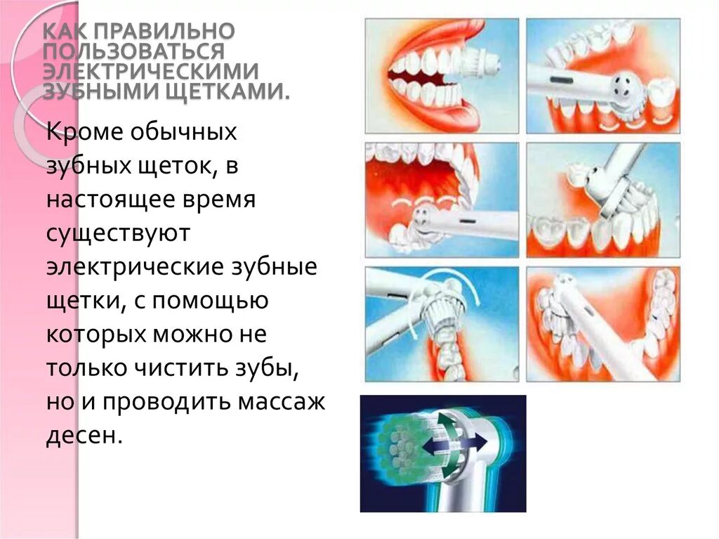 Правильная методика чистки зубов зубной щёткой. Правильная техника чистки зубов электрической щеткой. Как правильно чистить зубы электрической щеткой. Правильная методика чистки зубов электрической щеткой. Можно ли чистить зубы ребенку