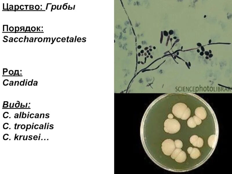 Грибы candida albicans. Candida albicans морфология. Кандида альбиканс микробиология. Дрожжеподобные грибы рода Candida.