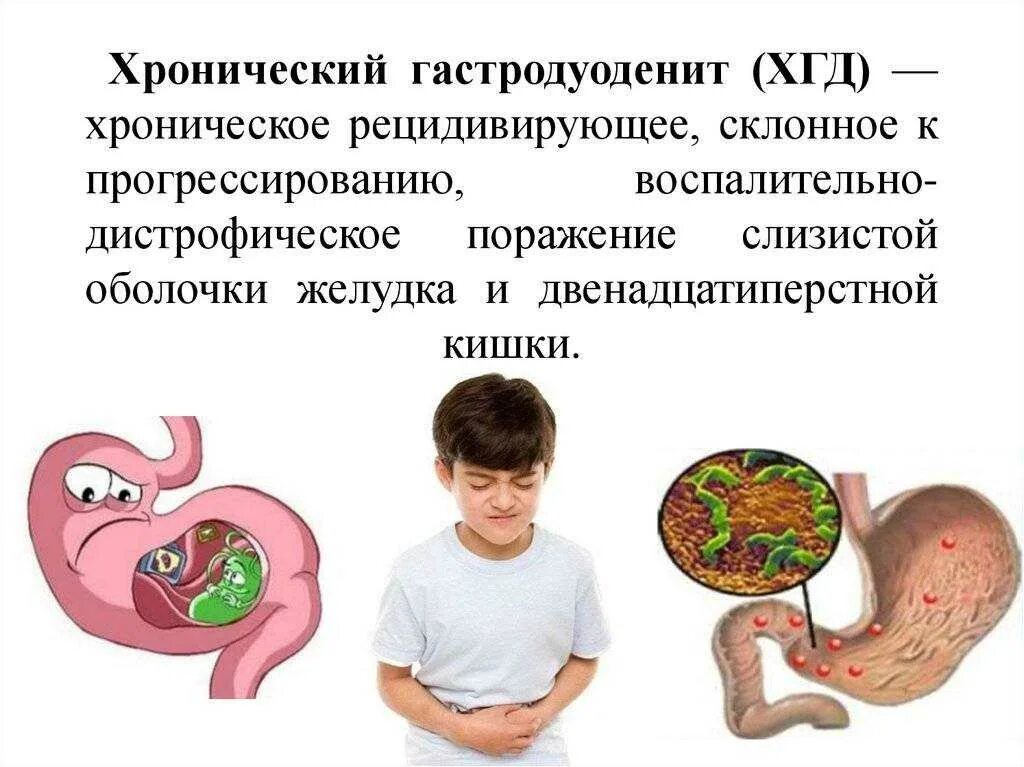 Алгоритм диагностики функциональной диспепсии. Классификация язвенной болезни у детей таблица. Язвенная болезнь пропедевтика внутренних болезней. Болезни желудка у детей клинические рекомендации. Пищевод баррета патогенез.