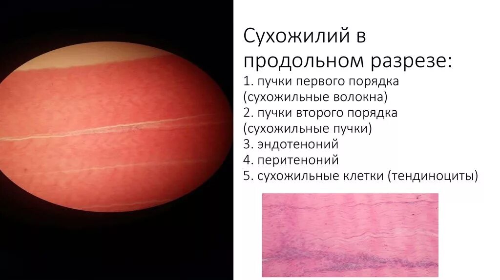 Сухожилие поперечный разрез. Продольный срез сухожилия гистология препарат. сухожилие в поперечном разрезе гистология. продольный разрез сухожилия гистология. сухожилие в поперечном разрезе гистологический препарат.