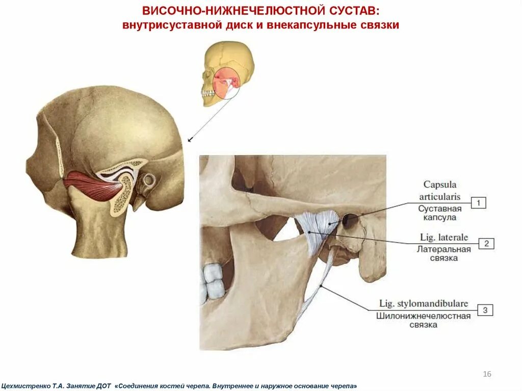 Соединение нижнечелюстной и височной кости. Внутрикапсульные связки височно-нижнечелюстного сустава. Связки височно-нижнечелюстного сустава анатомия. Височно-нижнечелюстной сустав строение связки. Мышцы и связки височно-нижнечелюстного сустава.